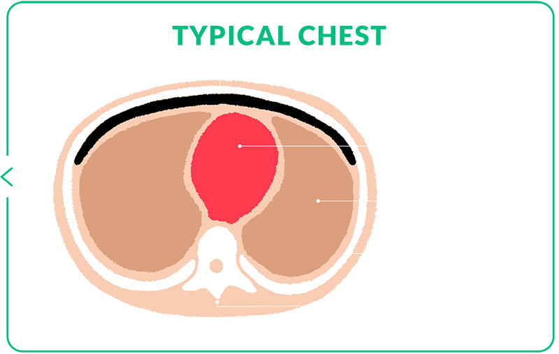 typical chest cross section